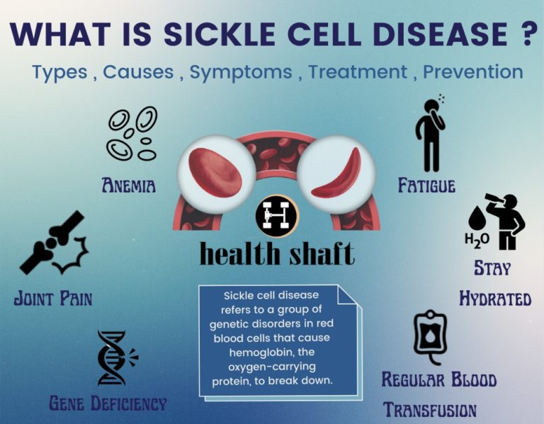 Everything about SCD : Sickle Cell Disease - Health Shaft